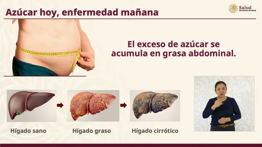 Diapositiva9